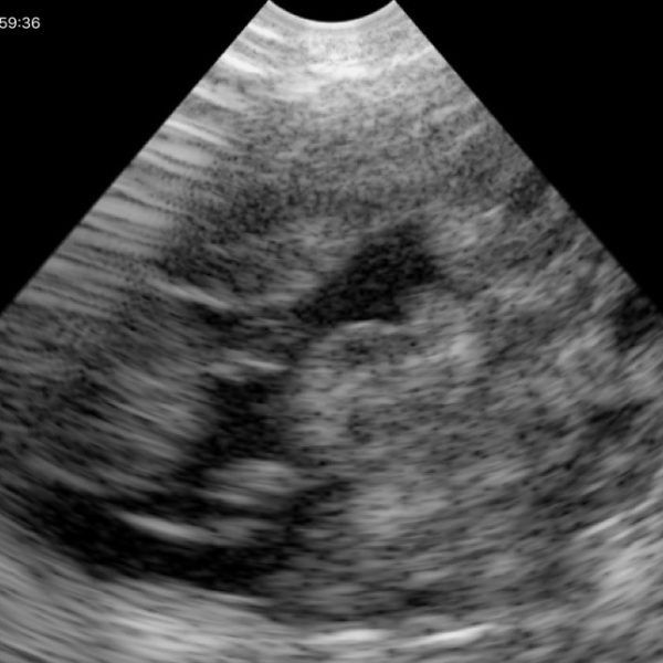 SV-3 Wireless Ultrasound iPad Probe